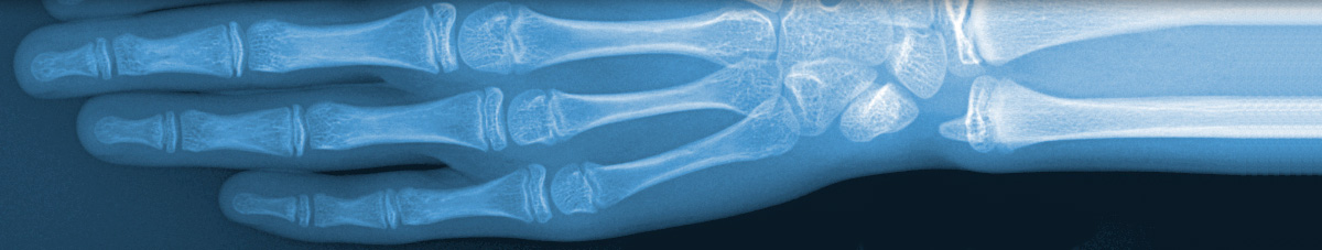 MDIG | Hand X-Ray