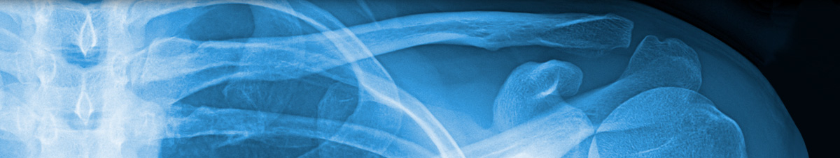 Shoulder X-Ray